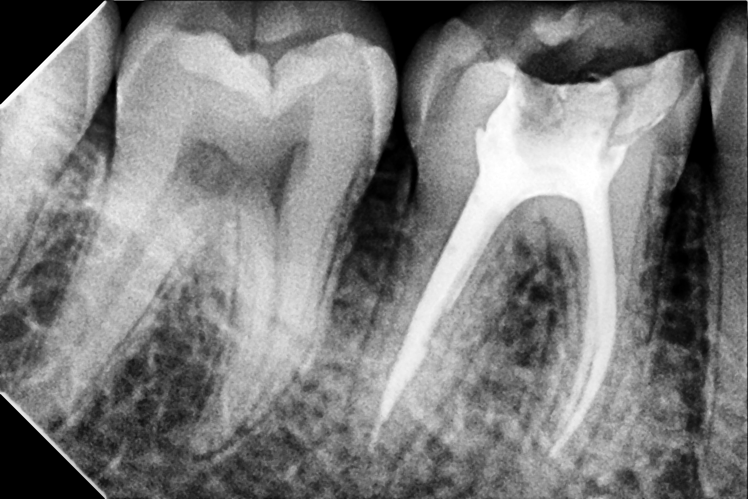 Before Treatment